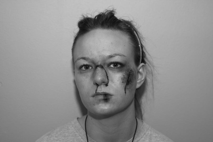 beaten up face. Battered Face Close Up